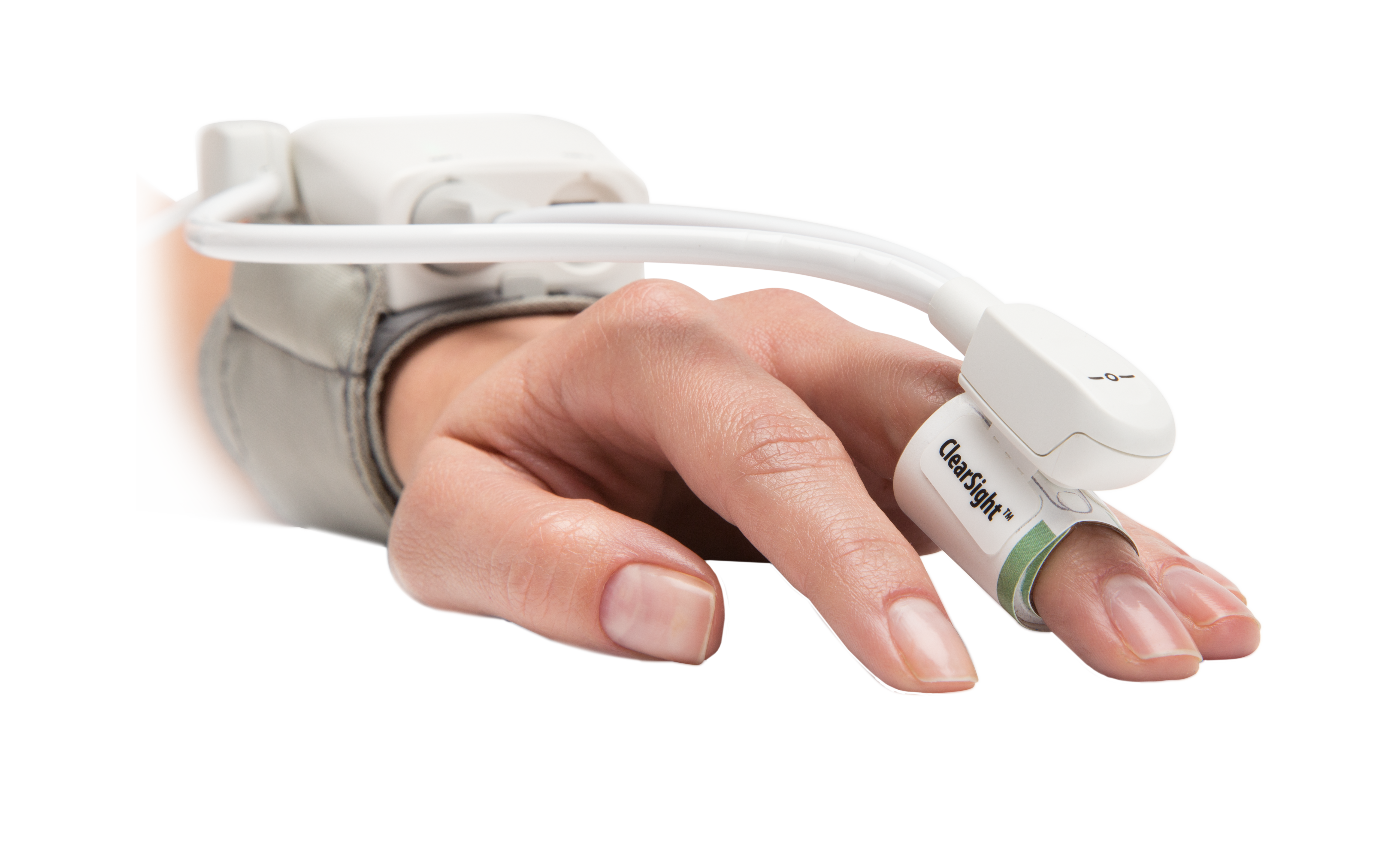 O sensor FloTrac se conecta a uma linha arterial existente e atualiza automaticamente os par&acirc;metros avan&ccedil;ados a cada 20 segundos.